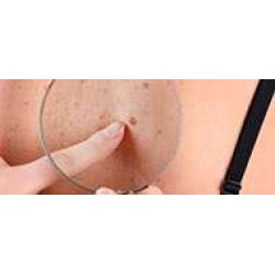 ΔΕΡΜΑΤΙΚΕΣ ΚΑΤΑΣΤΑΣΕΙΣ